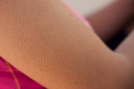 Why do we get goosebumps