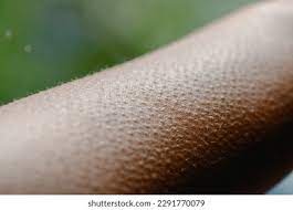 Why do we get goosebumps