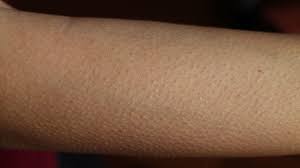 Why do we get goosebumps