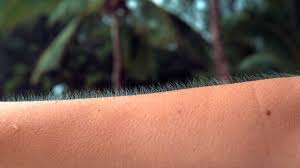 Why do we get goosebumps